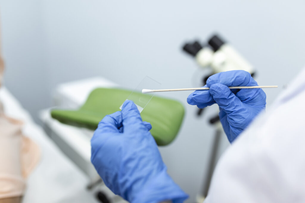 Nieprawidłowa cytologia – co oznacza wynik i co zrobić dalej?